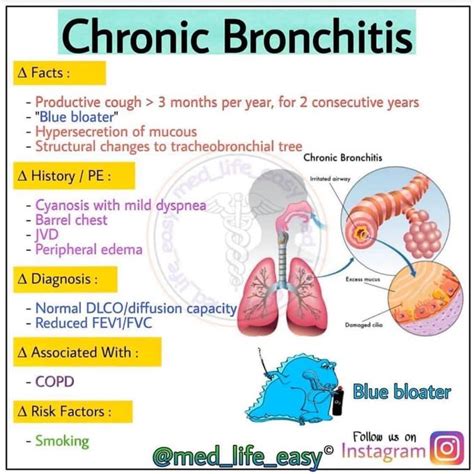 Understanding Bronchitis
