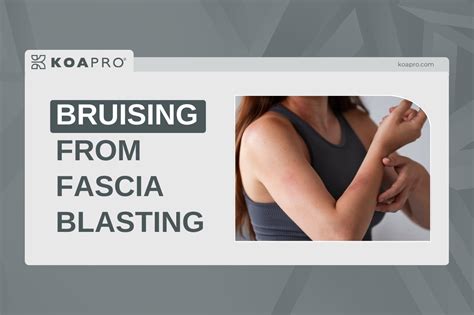 Understanding Bruising
