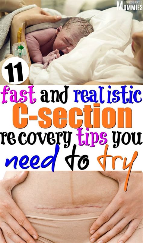 Understanding C-Section Recovery