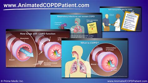 Understanding COPD