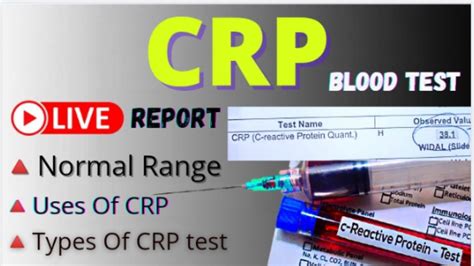 Understanding CRP Blood Report