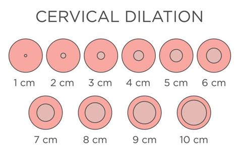 Understanding Cervix Dilation