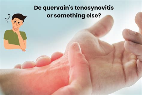 Understanding De Quervain's Tenosynovitis