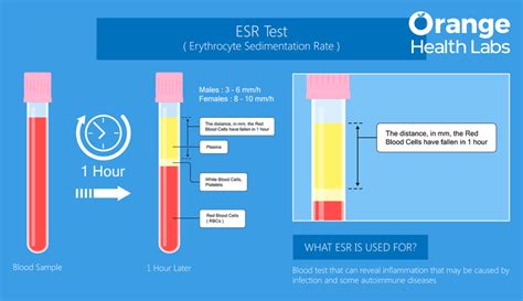 Understanding ESR Results