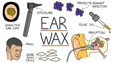 Understanding Ear Wax