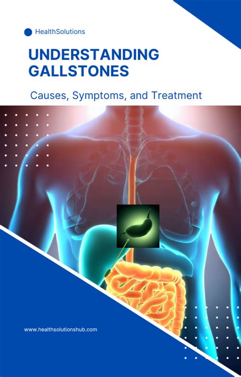 Understanding Gallstones