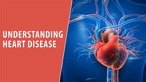 Understanding Heart Disease
