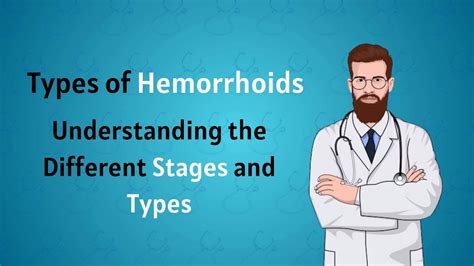 Understanding Hemorrhoids