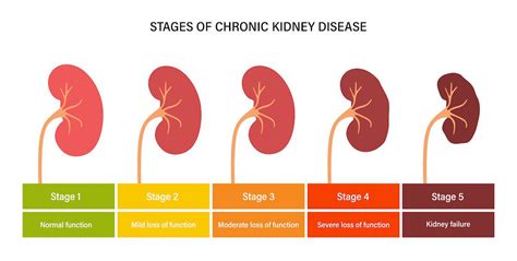Understanding Kidney Disease