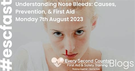 Understanding Nose Bleeds