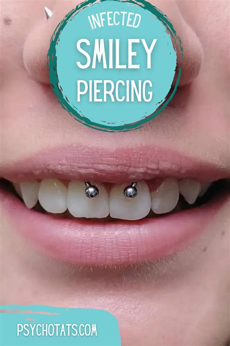 Understanding Piercing Infections