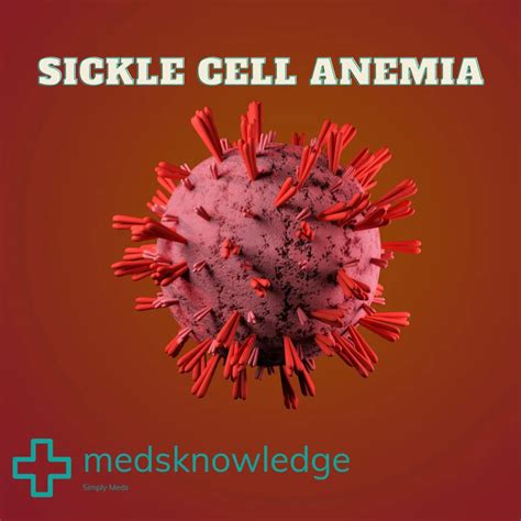 Understanding Sickle Cell Anemia