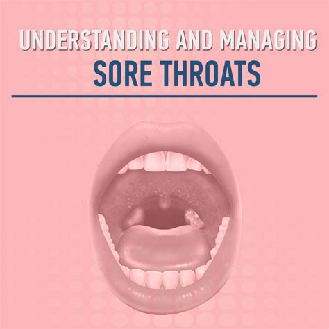 Understanding Sore Throat Headache