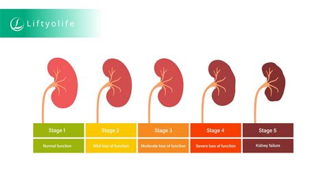 Understanding Stage 3 Kidney Failure