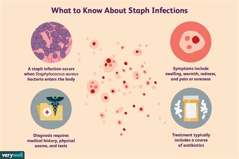 Understanding Staph Infections