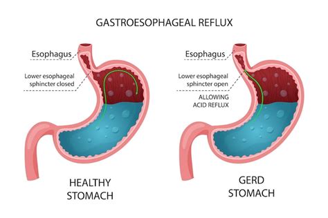 Understanding Stomach Sensation