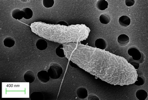 Understanding Tummy Bugs