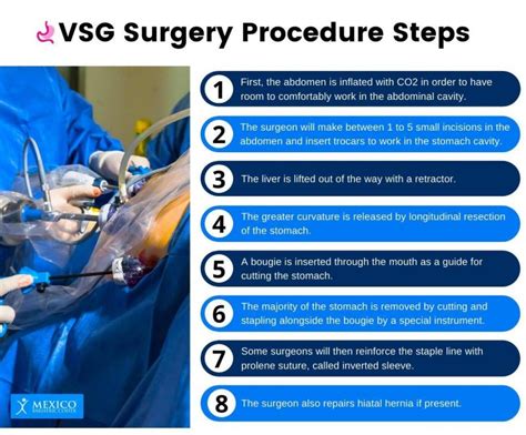 Understanding VSG Surgery