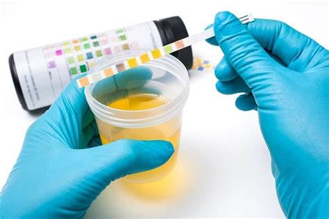 Urinalysis Analysis