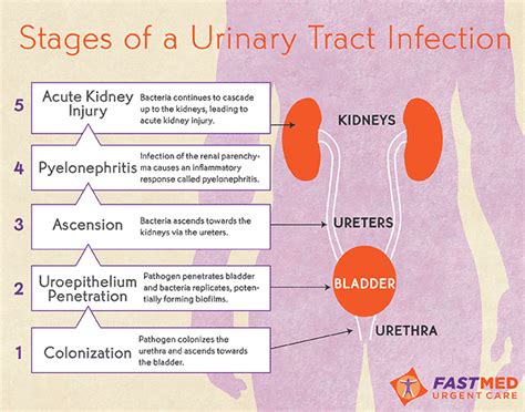 Urinary Tract Infections