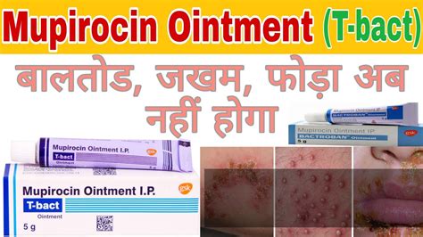 Uses of Mupirocin Ointment