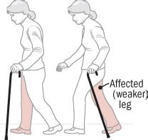 Using the Cane Correctly
