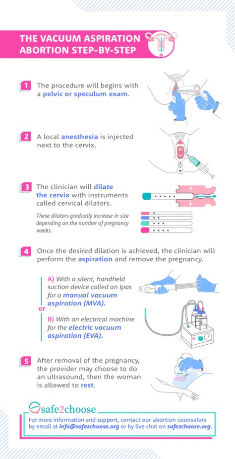 Vacuum Aspiration Abortion