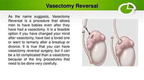 Vasectomy Reversal Procedure