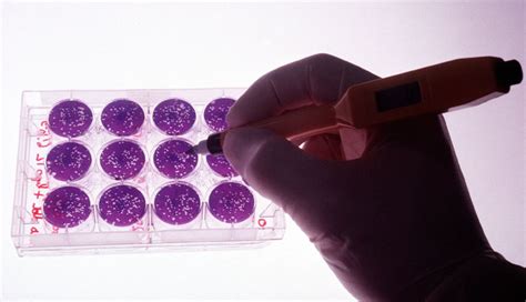 Viral Culture Test