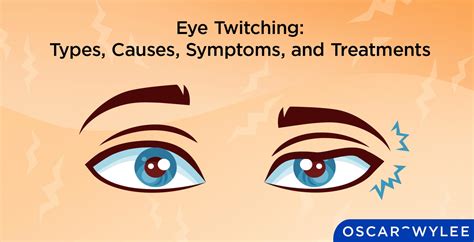 When to Seek Medical Attention for Eye Twitching Top Lid