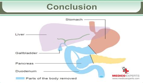 Whipple Procedure Conclusion