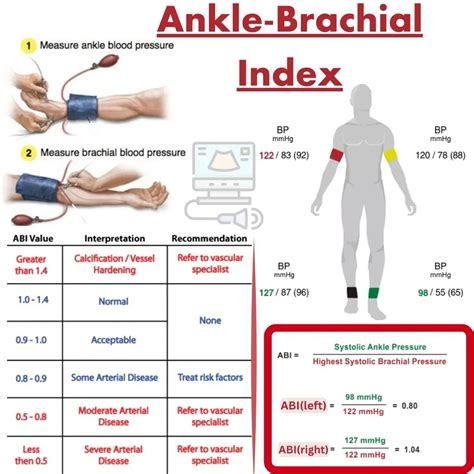 Who Should Have Ankle Brachial Index Test