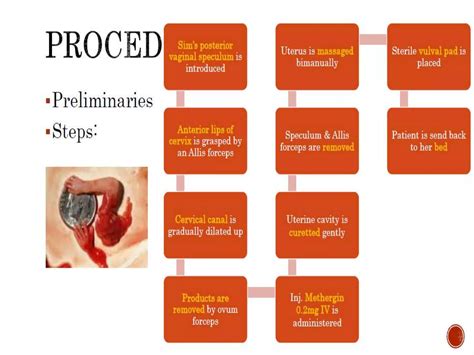 Working Mechanisms of the D&E Procedure