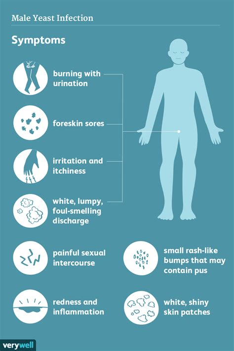 Yeast Infection Signs