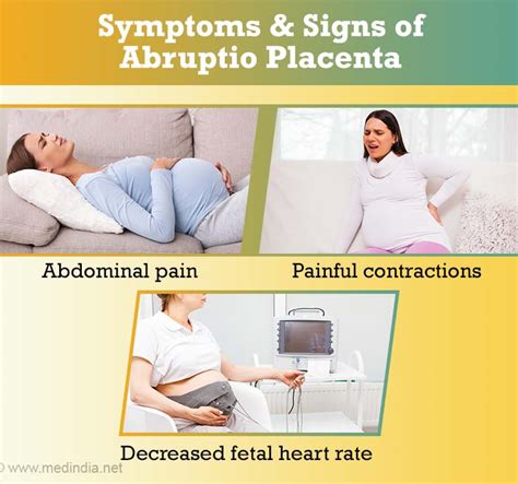 Abruptio Placentae Signs and Symptoms