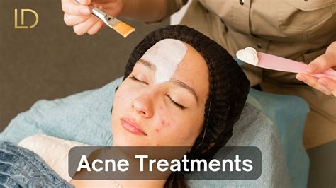 Calamine lotion for acne and pimples
