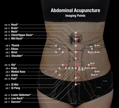 acupuncture procedure