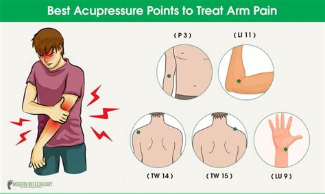 Acupuncture for Arm Pain Relief