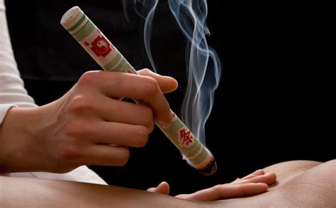 Acupuncture and Moxibustion