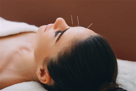 acupuncture treatment