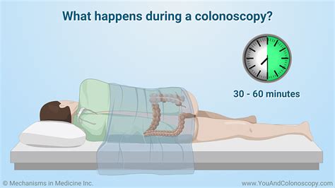 after colonoscopy