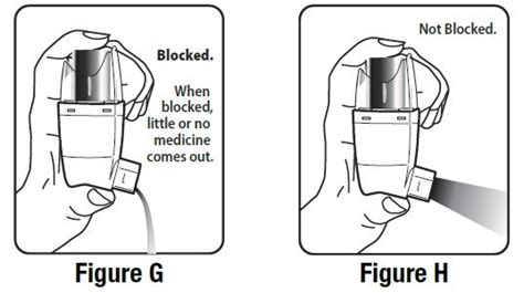 albuterol nebulizer maintenance