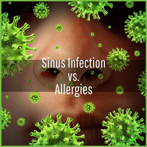 Allergies and sinus infections