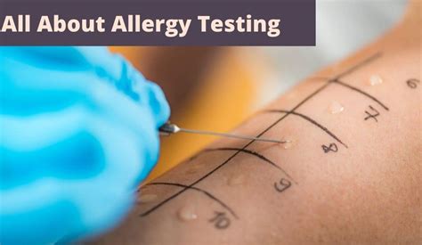 allergy testing