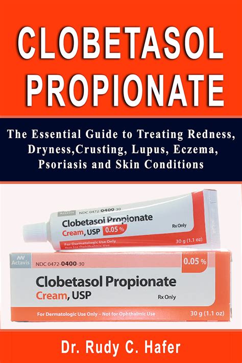 alternatives to clobetasol cream