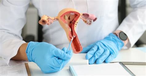 Alternatives to Tubal Ligation