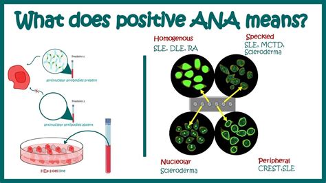 ANA Positivity