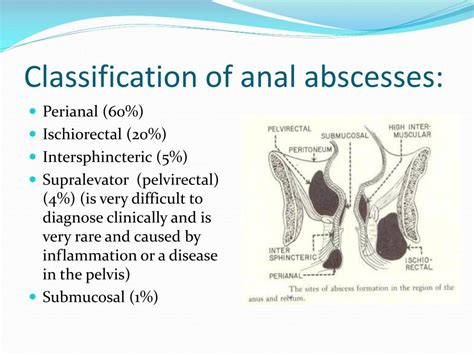 Anal Cyst Symptoms
