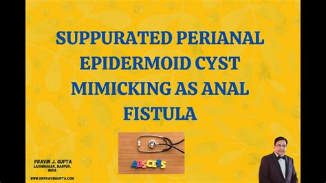 Anal Cysts