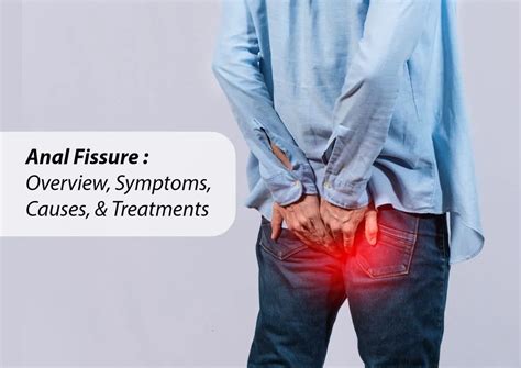 Anal Fissure Causes